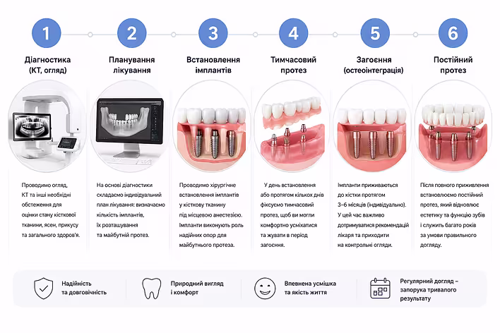 Етапи повного відновлення зубів на імплантах: діагностика, планування, встановлення імплантів, тимчасовий протез, загоєння та постійний протез