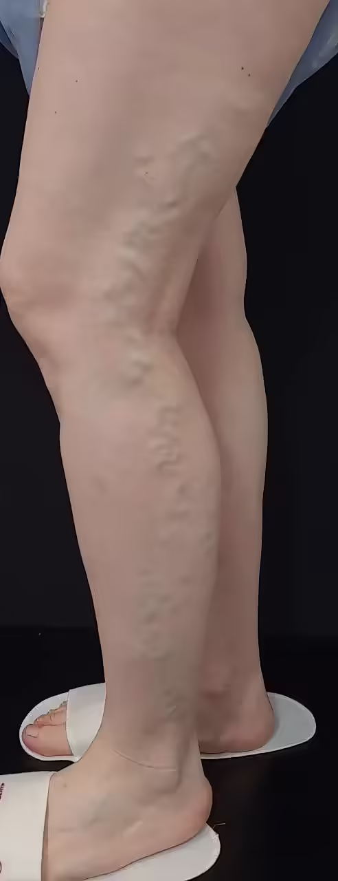 1 (2).png